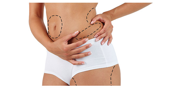 Get Liposuction Near Me Get Liposuction Near Me