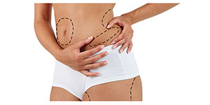 Get Liposuction Near Me Get Liposuction Near Me