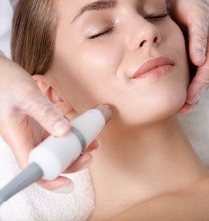 IPL Photofacial