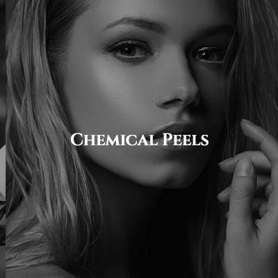 Chemical Peels in Los Altos CA Chemical Peels in Los Altos CA